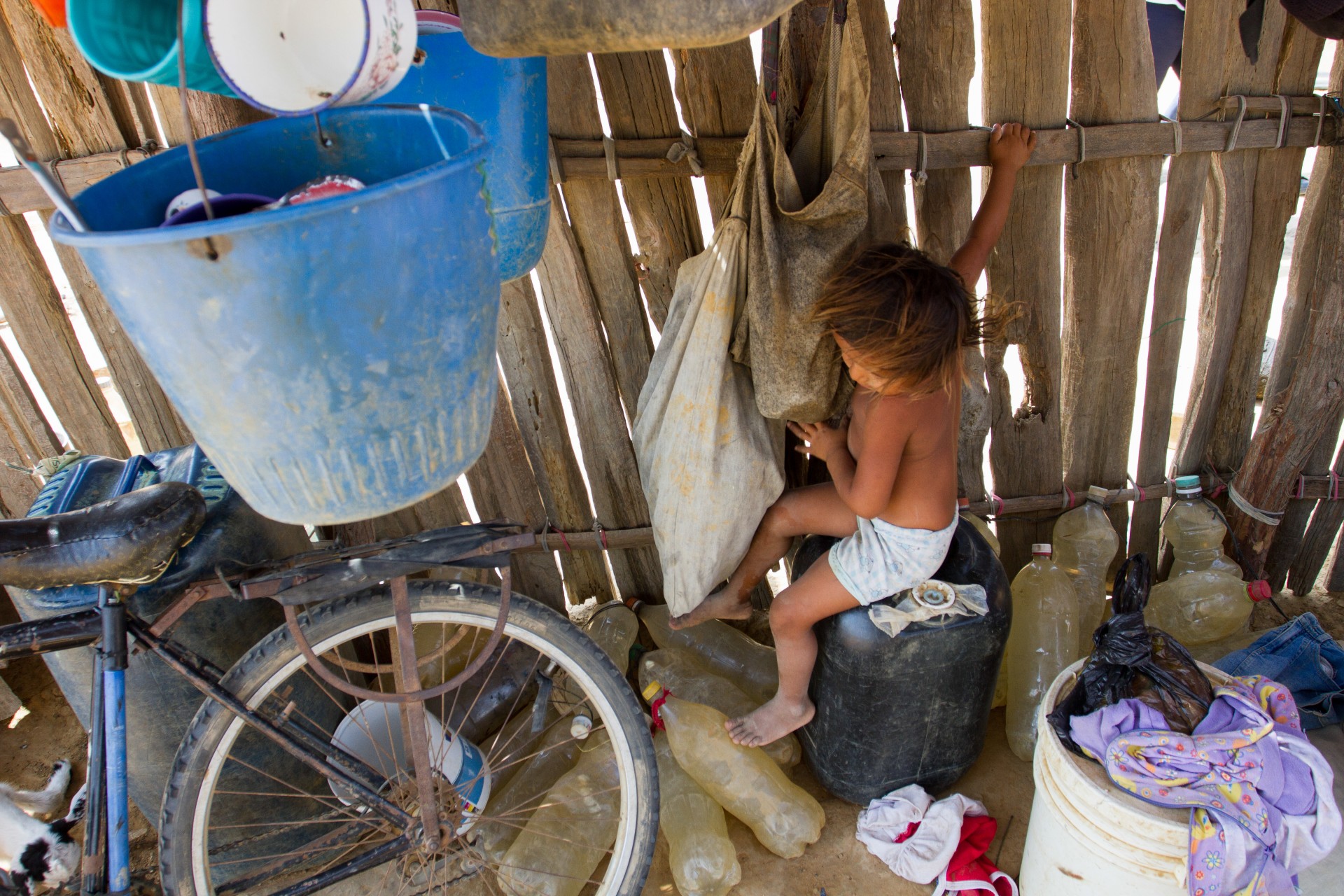 Desnutrición en La Guajira. 